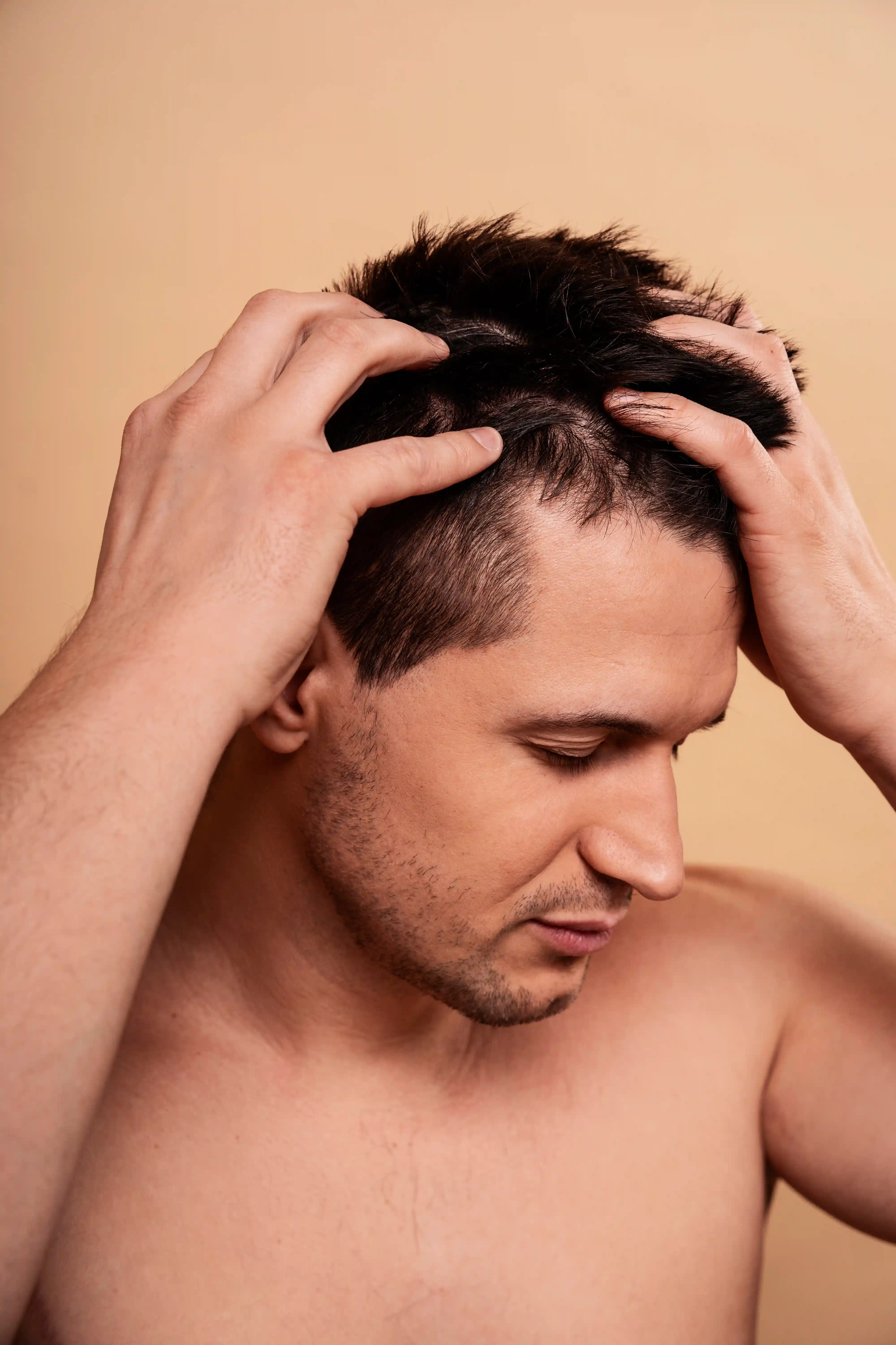 Entradas no Cabelo e Barba Falhada: Como Tratar a Calvรญcie Masculina de Dentro para Fora